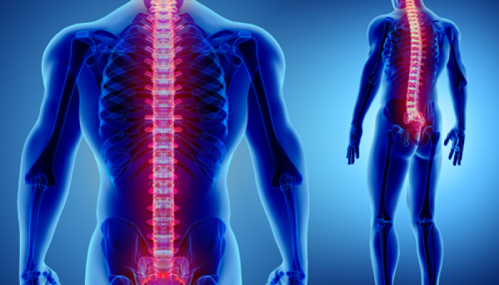 Spinal Cord Injuries